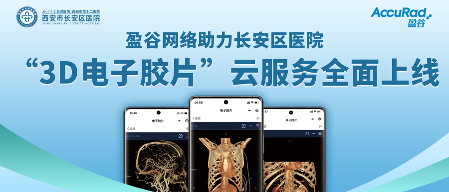 盈谷網(wǎng)絡(luò)助力長安區(qū)醫(yī)院“3D電子膠片”云服務(wù)全面上線！診斷結(jié)果、影像資料隨時隨地看！